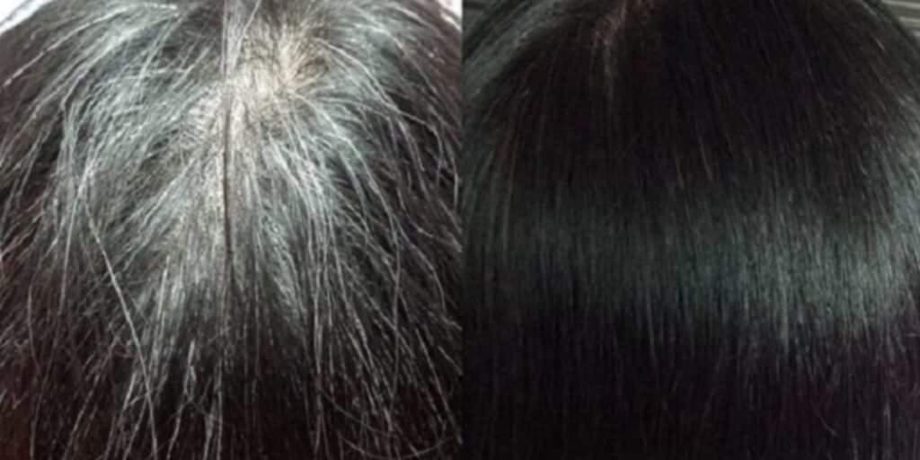 Grisalho exterminado e sem gastar NADA: Tinta caseira com 5 ingredientes acaba com o cabelo branco em 2 horas