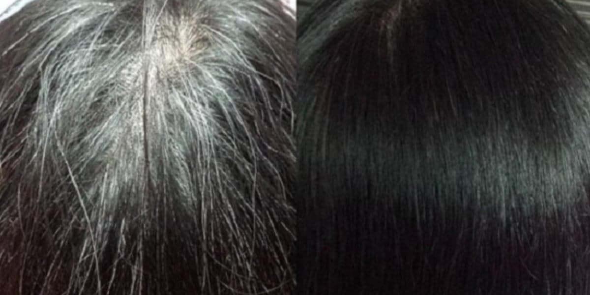 Mulher com cabelo branco e a mudança depois de usar a mistura especial (Foto: Reprodução/ Internet)