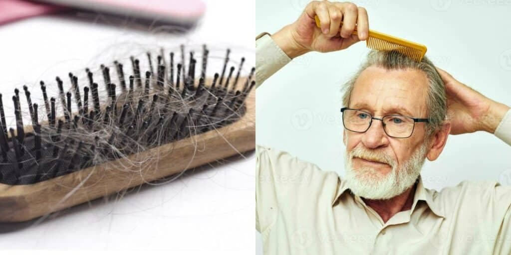 Idosos de 60, 70 e 80 com cabelos impecáveis: 5 remédios caseiros para senhores e senhoras chegarem na 3° idade IMUNES a queda de cabelo