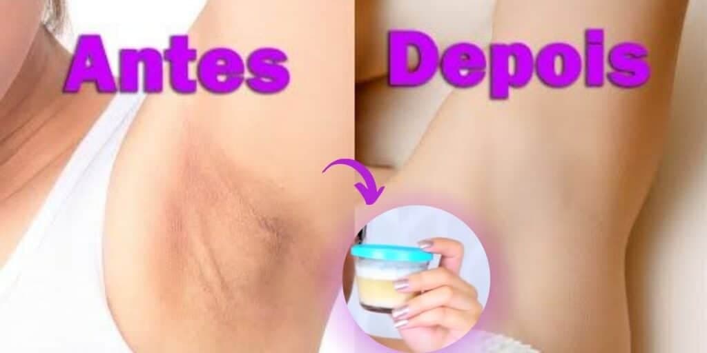 Fim das manchas escuras e mau cheiro: Misturinha e 6 dicas MILAGROSAS pra clarear as axilas imediatamente