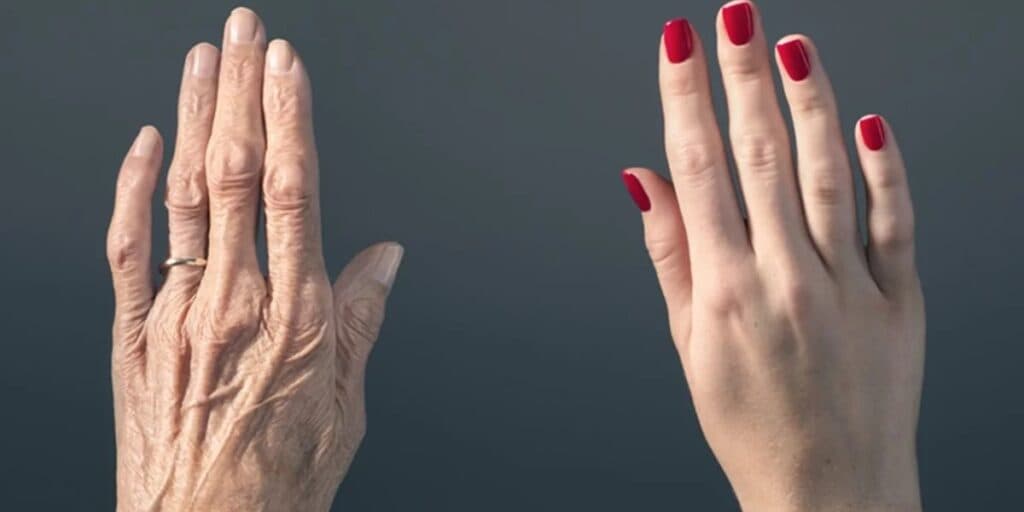 Mãos 30 anos mais jovem: Misturinha com 3 ingredientes e apenas 5 minutos dá adeus ao ressecamento e aos calos