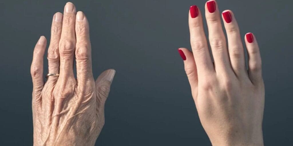 Fim das mãos ressecadas com rugas e calos: Volte a ter a pele lisinha com apenas 3 passos e em 10 minutos