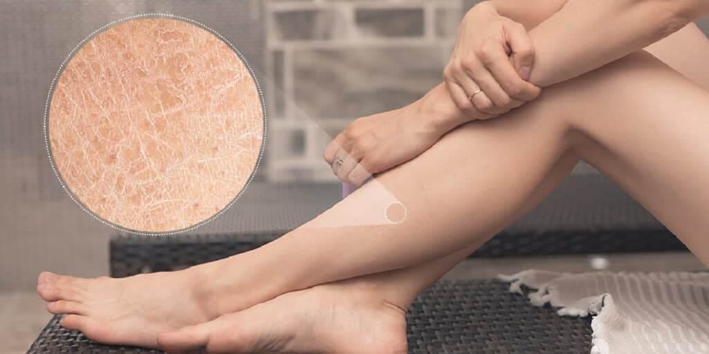 Babosa e +3 ingredientes caseiros: Receita milagrosa do melhor hidratante para dar fim as pernas ressecadas
