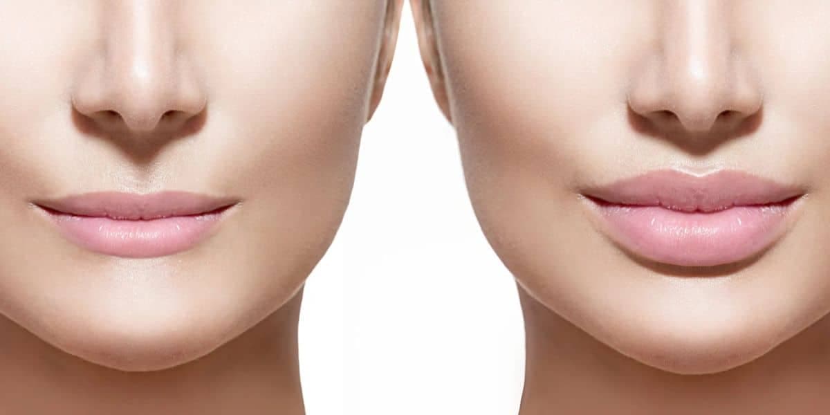 Exercícios para ajudar no preenchimento labial (Reprodução: Internet)