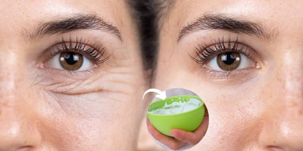 Sem rugas, varizes e rachadura nunca mais: 3 receitas milagrosas pra rejuvenescer décadas e arrasar no verão