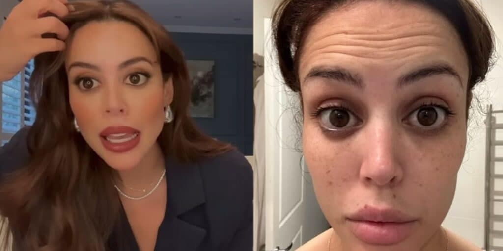 Pele rejuvenescida em 4 décadas: Único produto deixa botox no chinelo e elimina manchas e rugas em mulheres