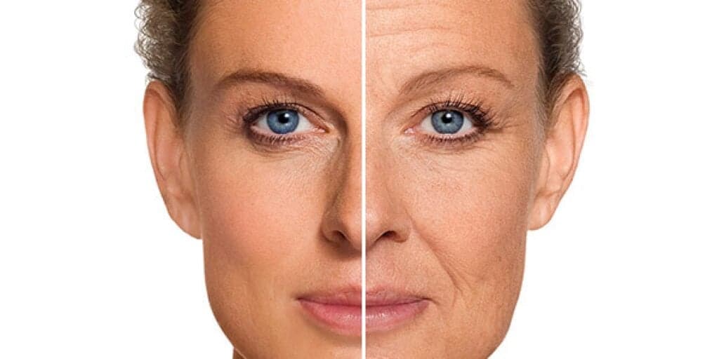 Mais potente que o botox: Mistura com 5 ingredientes elimina as rugas naturalmente e traz pele de porcelana