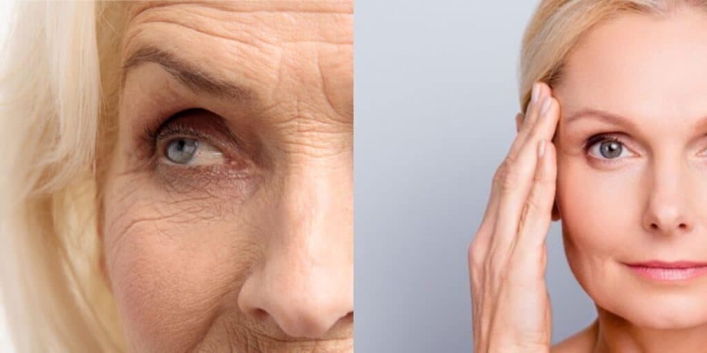 Carinha de 30 eternamente: 9 óleos naturais IMBATÍVEIS para rejuvenescer o rosto mais que qualquer botox