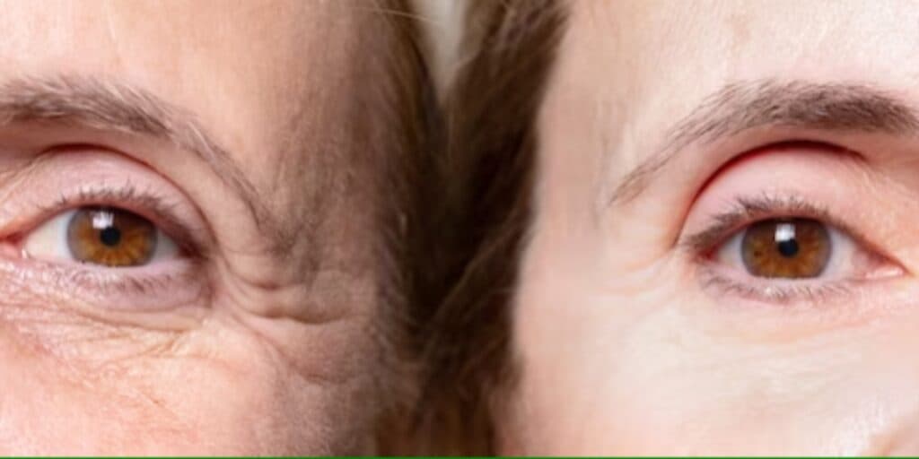 FIM das rugas: Receita caseira de colágeno com 5 ingredientes populares rejuvenesce 20 anos em 10 minutos