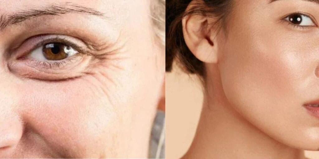 Bomba de colágeno natural: 3 ingredientes caseiros dão firmeza na pele das 45+ e fim nas rugas