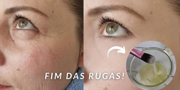 Clínicas escondem de você: Receitinha secreta do melhor colágeno só com 4 ingredientes pra dar adeus às rugas