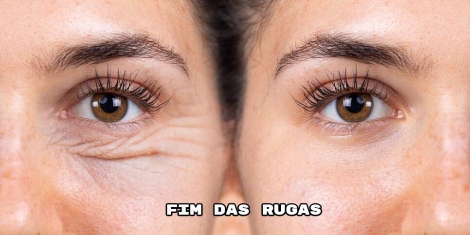 Fim das rugas e rostinho de 30 eternamente: Misturinha caseira de 3 ingredientes traz resultado em minutos