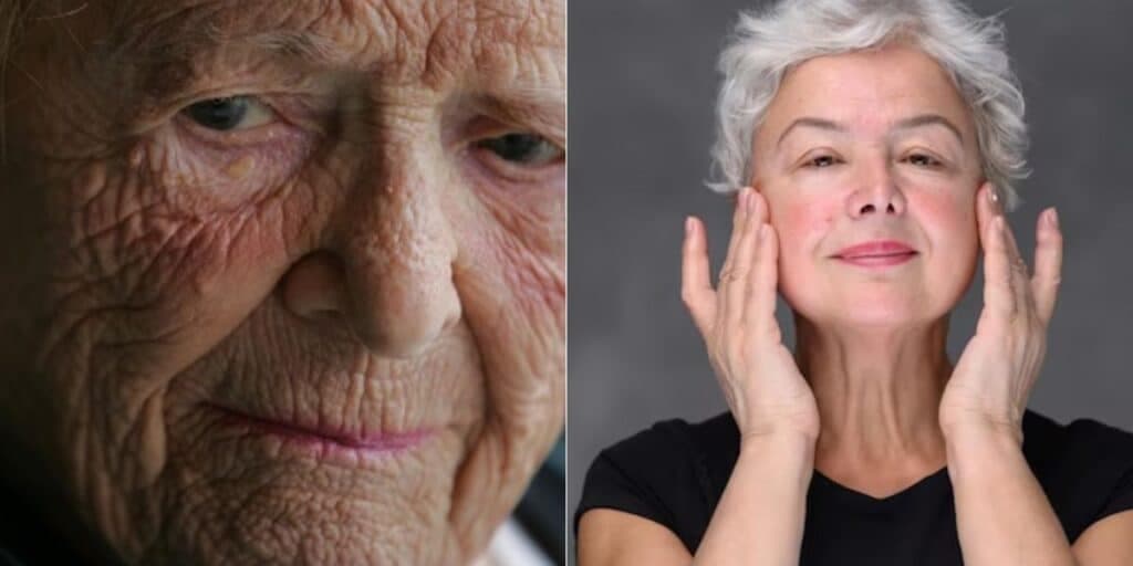 Idosas vão eliminar as doenças: 2 ingredientes INFALÍVEIS trazem a pele de porcelana e rejuvenesce