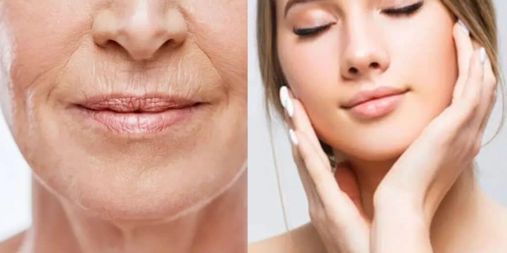 Botox quase eterno: Único produtinho suga as rugas e deixa mulheres de 50 a 80 com rostinho de porcelana