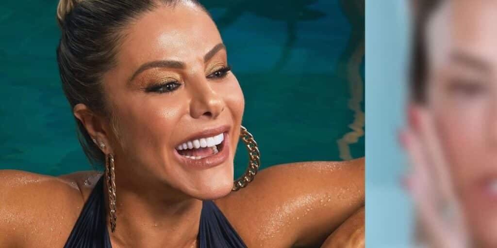 Mulher de Leonardo passa por cirurgia no rosto, surge irreconhecível e resultado choca: "Caída"
