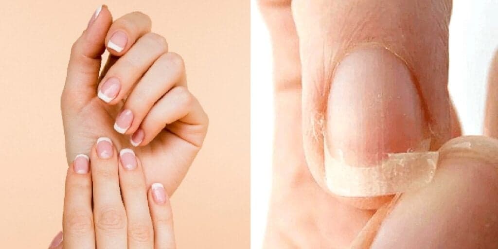 Adeus unhas quebradiças e fracas: Mistura caseira com apenas 3 ingredientes salva suas unhas
