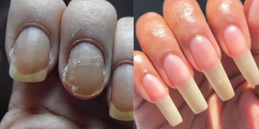 Alongamento natural e sem quebrar: Receita com 4 ingredientes pras unhas das mulheres durarem igual titânio