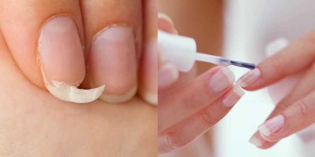 Fim da quebra e fortes como casco: Base natural com 4 ingredientes faz unhas durarem uma eternidade