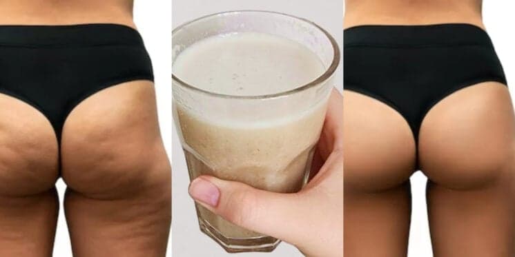 Dê adeus à celulite: Receitinha de colágeno caseiro com 3 ingredientes estica toda a pele de mulheres 50+