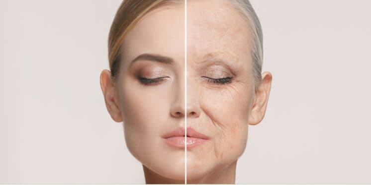 Mais potente que harmonização facial: Único ingrediente levanta a pele caída e dá fim das rugas em 20 minutos