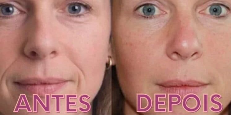3 décadas + jovem e sem plástica: 1 único produto que toda mulher tem extermina as rugas e o bigode chinês