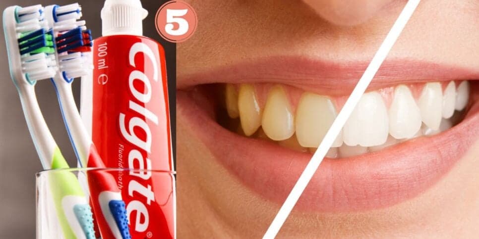 Colgate e dentistas provavelmente escondem: 5 clareamentos caseiros deixam os dentes brilhando sem gastar nada