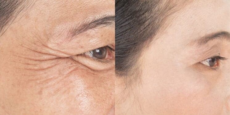 Mulheres de 60+ com rostinho de 30 anos: 4 segredos melhores do que o botox pra nunca mais ter rugas e marcas