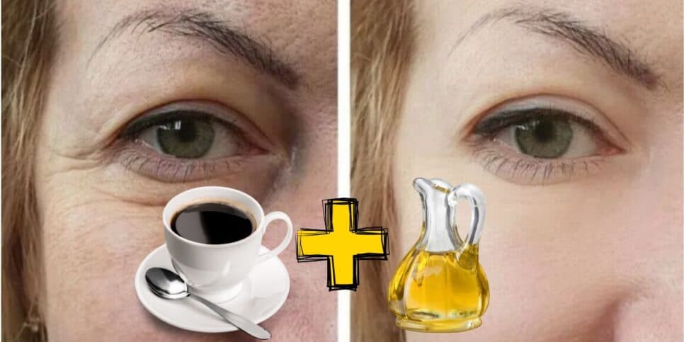 20 anos rejuvenescidos em DIAS: 8 misturas caseiras, com café e azeite, trazem o melhor BOTOX do mundo as 50+