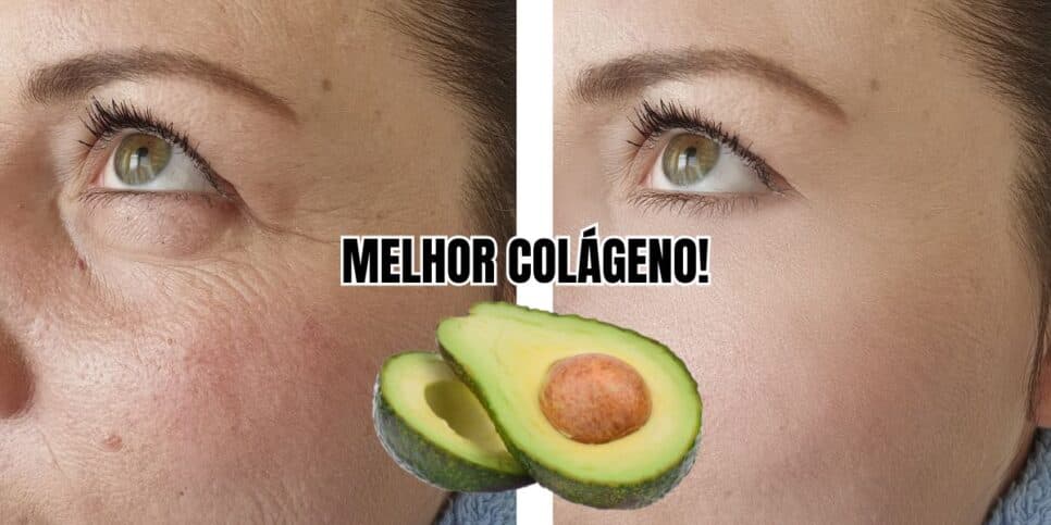 Rugas eliminadas: Melhor colágeno do mundo com abacate + 2 ingredientes deixa pele de senhoras 60+ lisinha