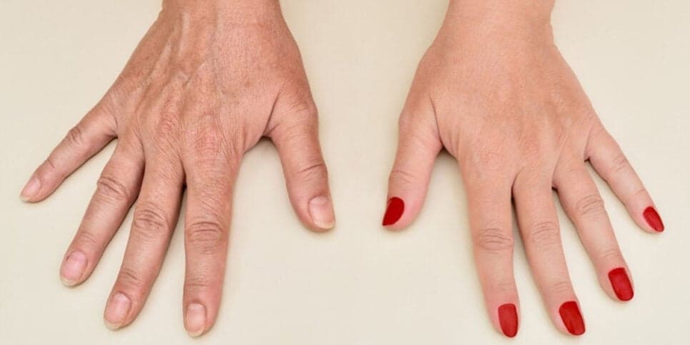 Mãos macias como de bebê: Misturinha com 2 ingredientes dá fim a pele ressecada e manchas de senhoras 60+