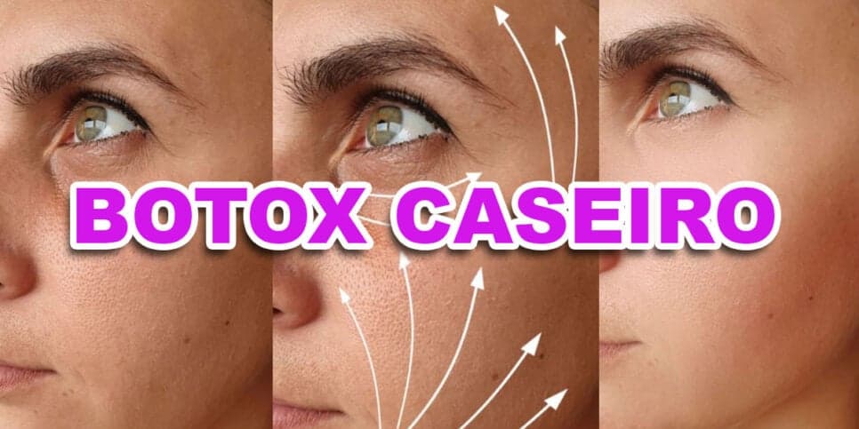 Fonte da juventude: Botox caseiro com 3 ingredientes dá fim as rugas e devolve 30 anos durante a noite