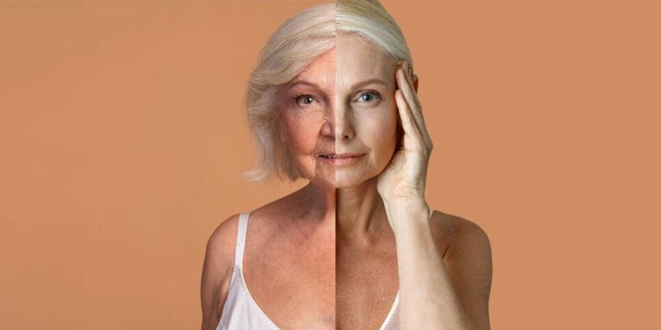 Pele com e sem rugas (Foto: Reprodução, Montagem - TV Foco)