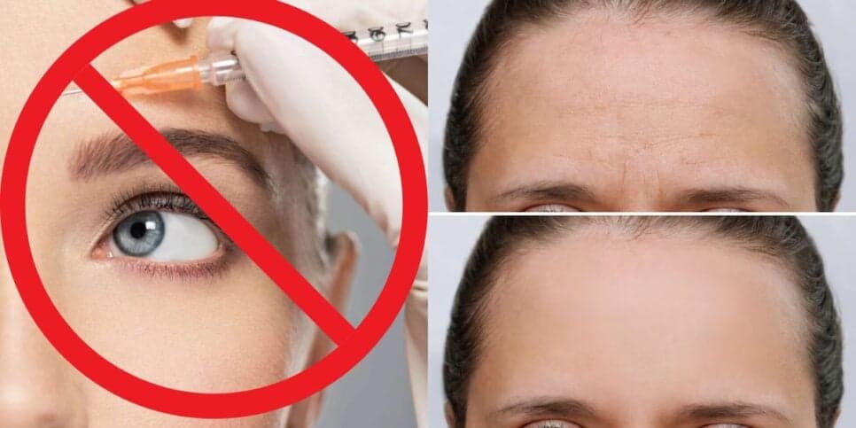 Pode se despedir do botox pra pele e cabelos: Melhor colágeno do mundo rejuvenesce mulheres com 1 ingrediente