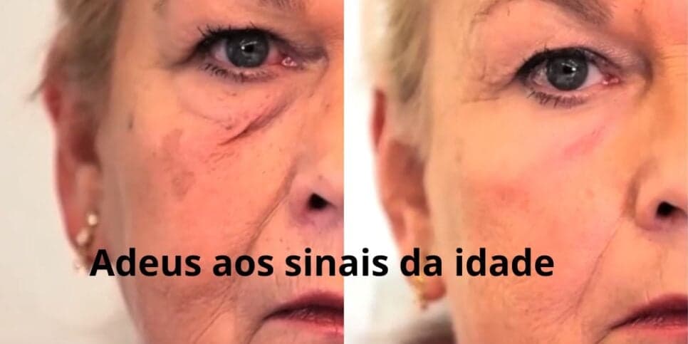 Colágeno eterno: 4 segredos milagrosos sugam qualquer sinal de idade e dão fim aos problemas de saúde das 60+