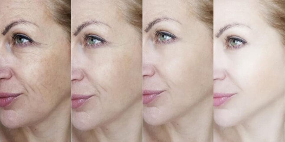 Melhor e mais barato que botox: 5 esfoliantes naturais sugam até 30 anos de quem tem 60+