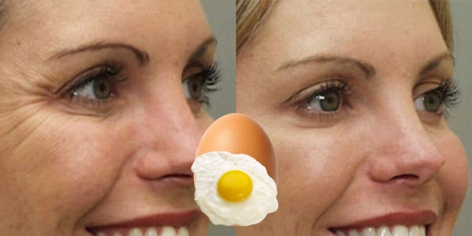 Botox caseiro e infalível: Receita secreta pra pele com ovo e +4 ingredientes faz o que nem a harmonização faz