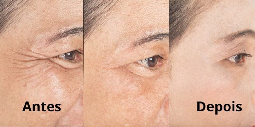 Pele de porcelana: Receita caseira com 4 ingredientes acaba com as rugas e faz rejuvenescer qualquer pessoa