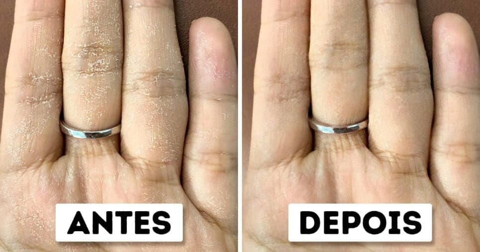 Mãos 30 anos mais jovem: Misturinha caseira com apenas 3 ingredientes e em 5 minutos dá adeus ao ressecamento e aos calos