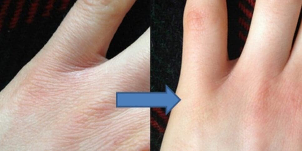 Tratamento caseiro para as mãos ressecadas (Foto: Reprodução/ Internet)