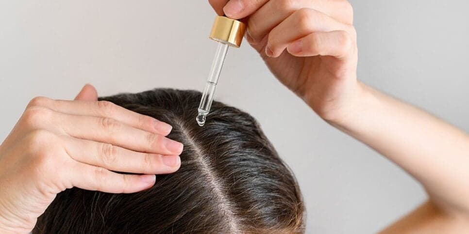 Cuidado ao aplicar o Minoxidil (Reprodução: Internet)
