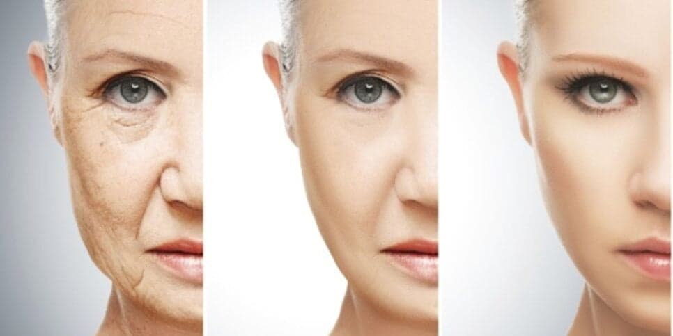 Lisinha e imune as rugas: Melhor ácido hialurônico do mundo é caseiro e as 50+ podem fazer com 2 ingredientes