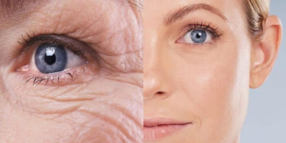 Fim do ressecamento e flacidez no frio: Botox natural com mel paralisa o envelhecimento das 40+ em 4 passos
