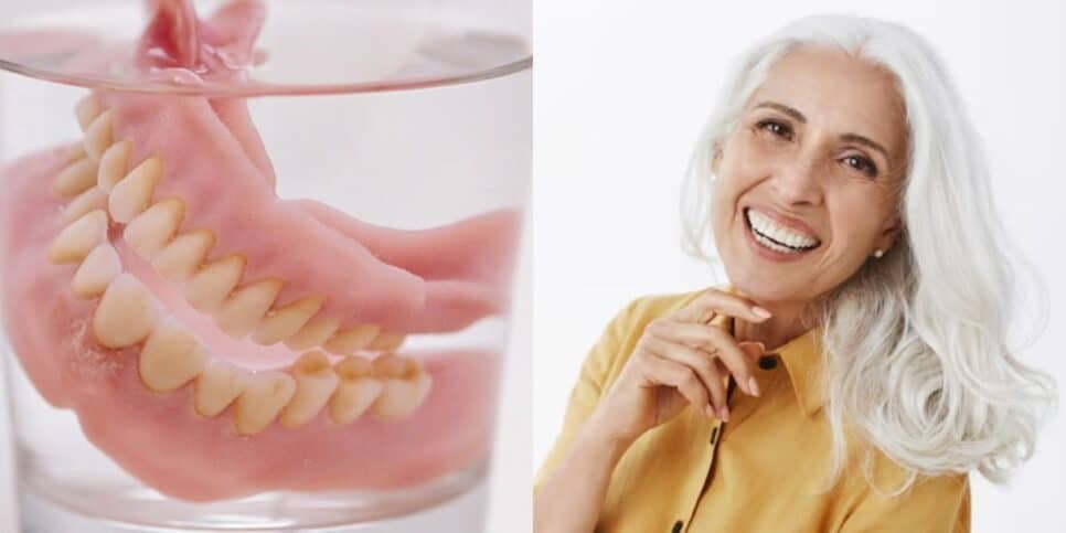 Dentistas escondem: 3 passos garantem dentaduras melhor que prótese dentária e rejuvenescem idosas 60+