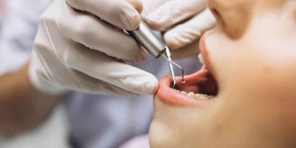 Vá de maneira constante, ao menos a cada 6 meses, para fazer a limpeza (Reprodução: Internet)