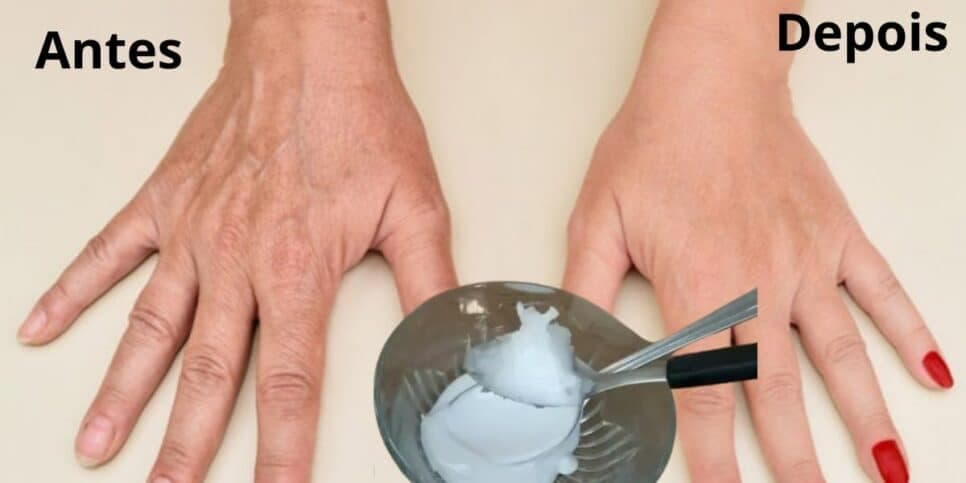 Adeus as manchas: Misturinha caseira com 3 ingredientes deixa as mãos 30 anos mais jovens em minutos