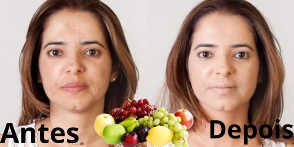 Melhor acido hialurônico do mundo: Mistura com 2 frutas suga as manchas da pele e deixa até 40 anos mais nova