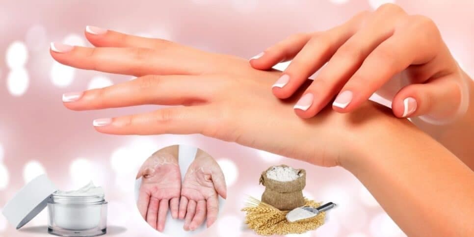 Mãos lisinhas como de bebê: Misturinha com farinha +3 ingredientes dá fim ao ressecamento e aos calos