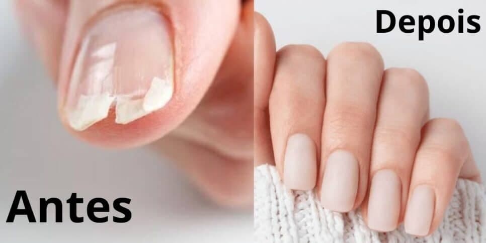 Indestrutíveis e longas: Esses 10 alimentos que você tem em casa deixam a unha das mulheres perfeitas