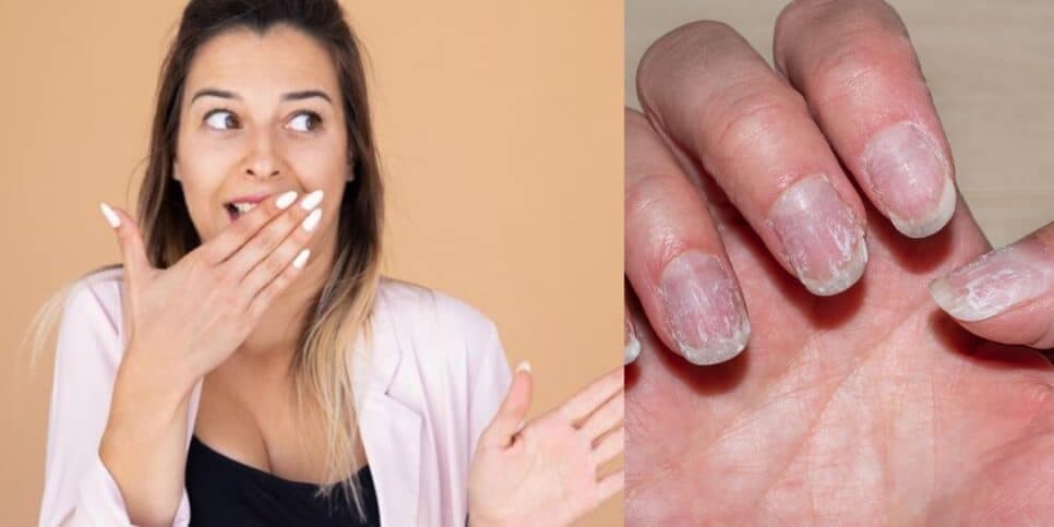 Nem a manicure vai salvar: 6 erros FATAIS deixam unhas quebradiças, podres, e mulheres 40+ devem banir agora
