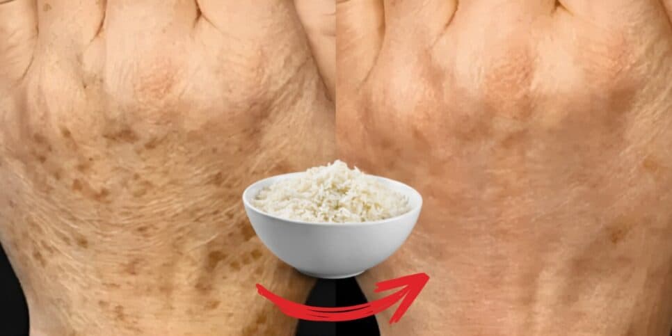 Fim das manchas e calos: 'Resto' do arroz é melhor que creme anti-idade e deixa as 60+ com mãos lisinhas